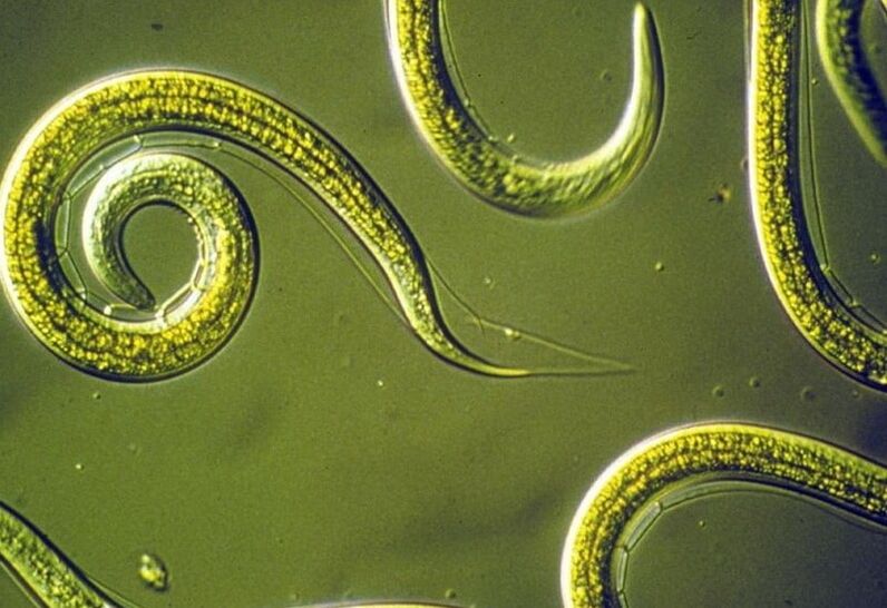 Spulwürmer aus dem menschlichen Körper