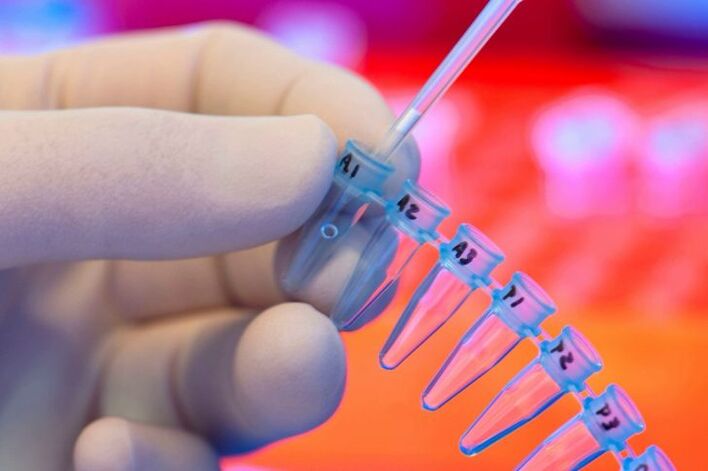 Welche Tests werden für Parasiten übergeben