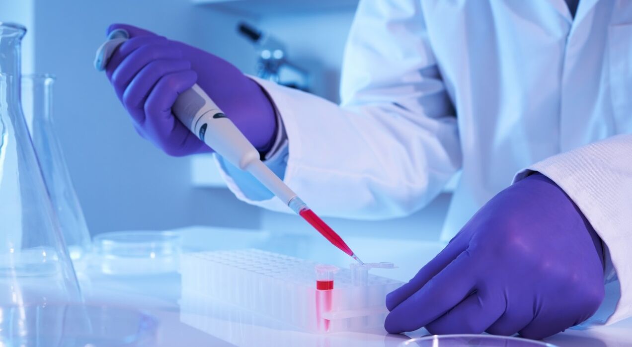 wie man eine Parasitanalyse durchführt