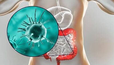 Welche Tests müssen auf das Vorhandensein von Parasiten durchgeführt werden