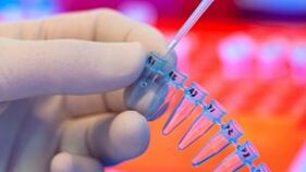 wie man sich auf Parasiten testen lässt
