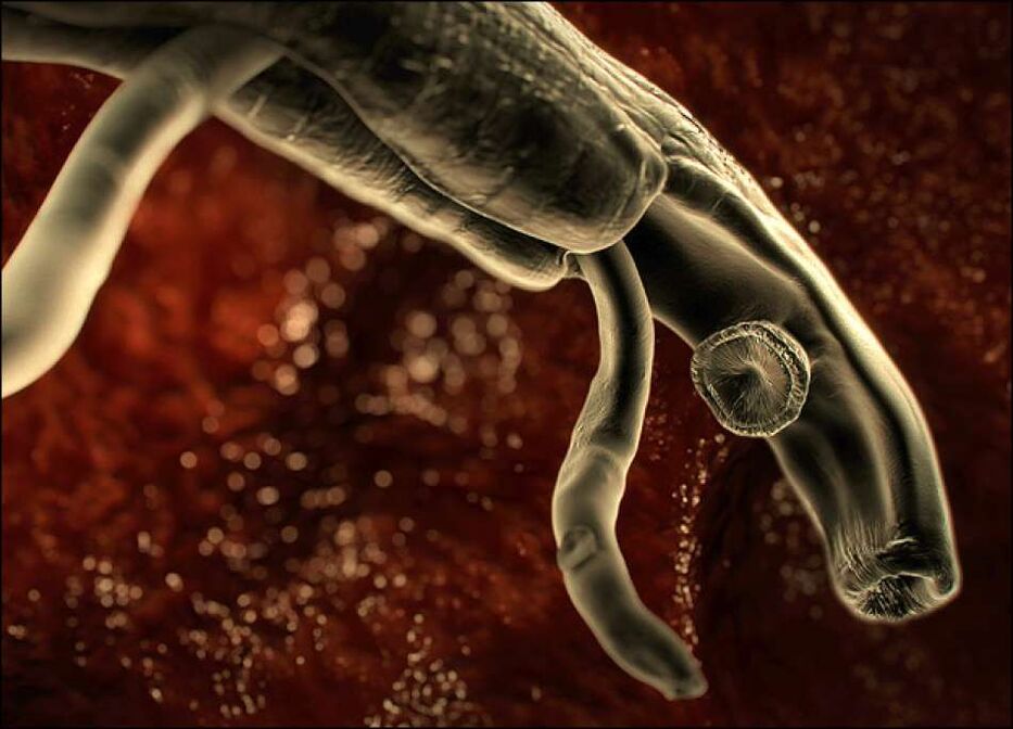 Parasiten im menschlichen Körper