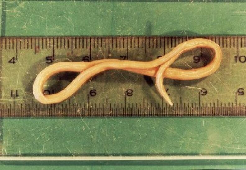 Spulwurmparasit aus dem menschlichen Körper