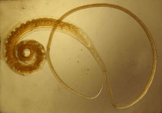 Trichinella-Wurm aus dem menschlichen Körper